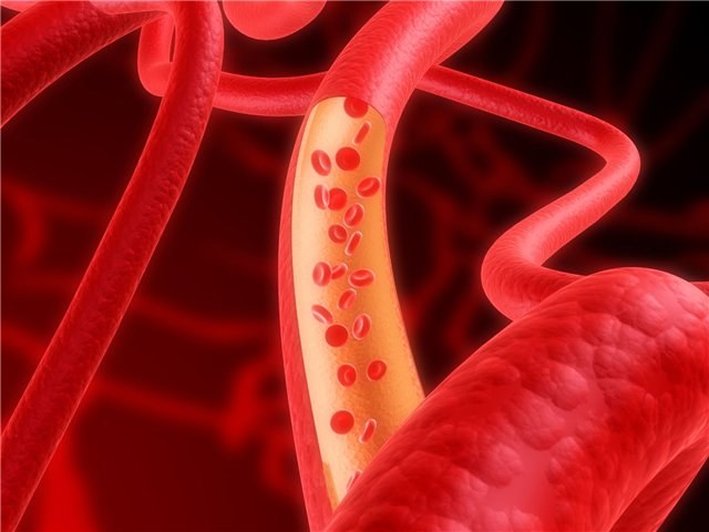 How to prevent atherosclerosis of blood vessels