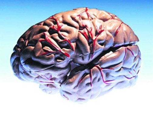 What is a cerebral stroke?