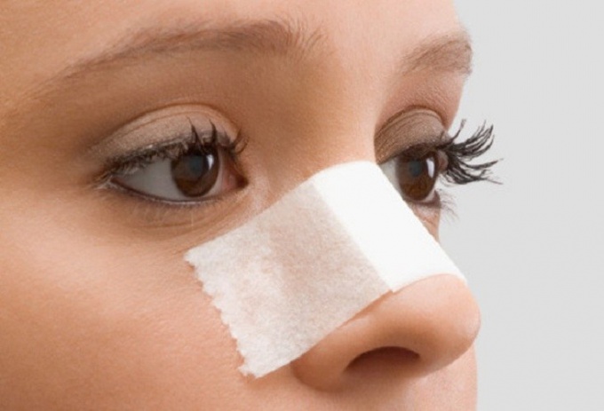 How long does rehabilitation after rhinoplasty take?